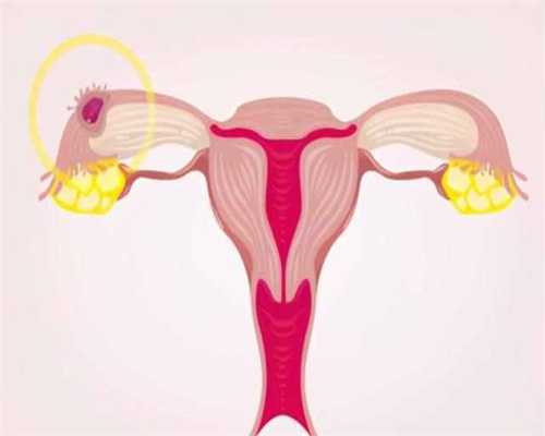 找人生孩子网站,试管取完卵移植手术多少钱？试管取完卵移植手术多少钱一次